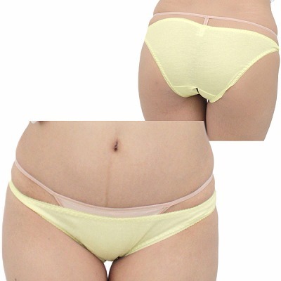 �L�k�����Q�R�b�g���ҊJ���t���o�b�N�@�C�G���[�i�����W�F���[�j